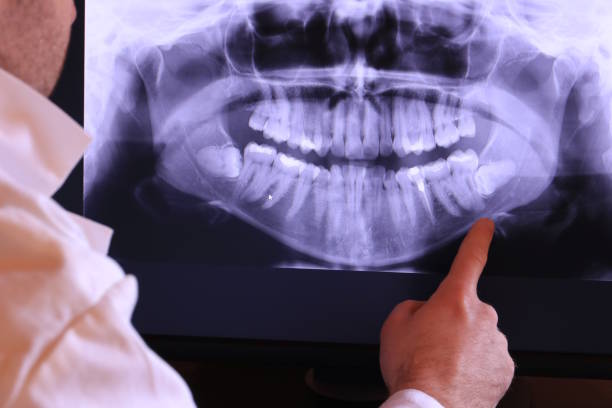 Best Weekend Emergency Dental Services in Schoolcraft, MI
