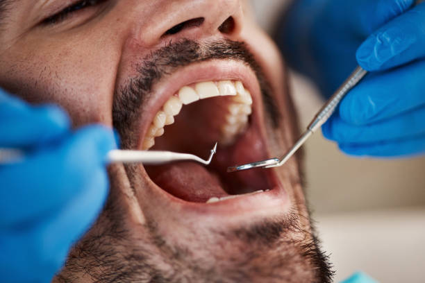 Best Emergency Treatment for Oral Infections in Schoolcraft, MI