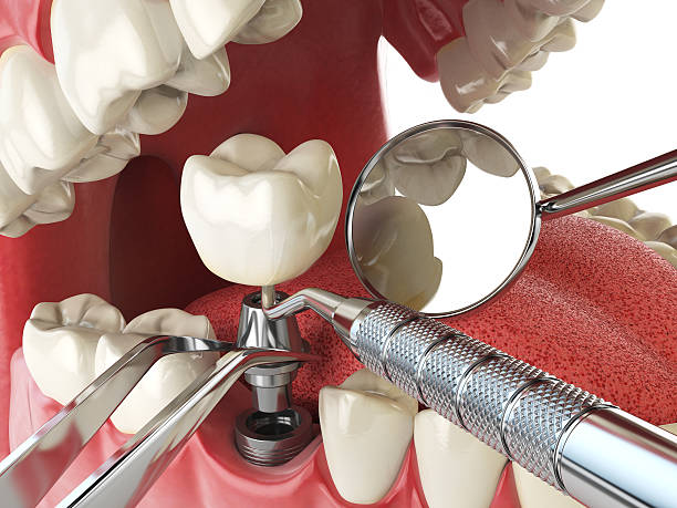 Best Emergency Treatment for Jaw Pain or Injury in Schoolcraft, MI